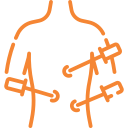 laparoscopy